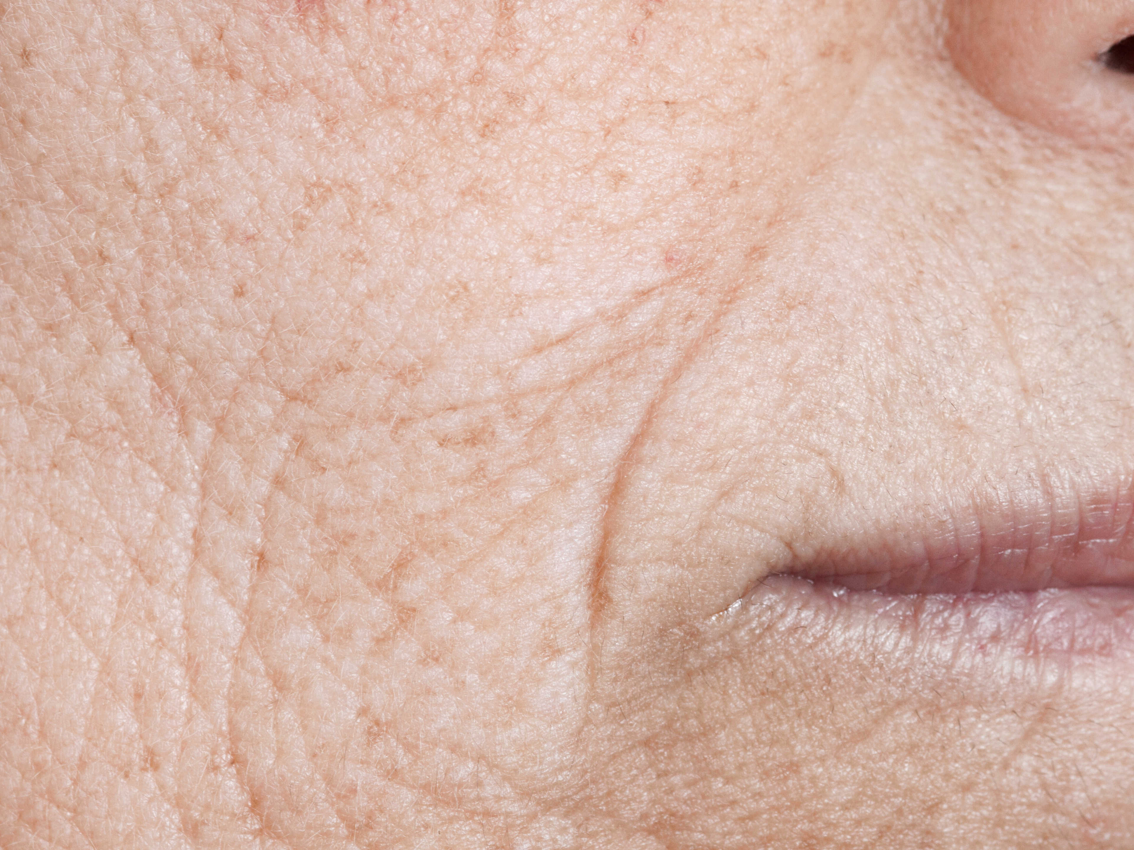 Understanding Oxidative Stress and Its Impact on Visible Aging